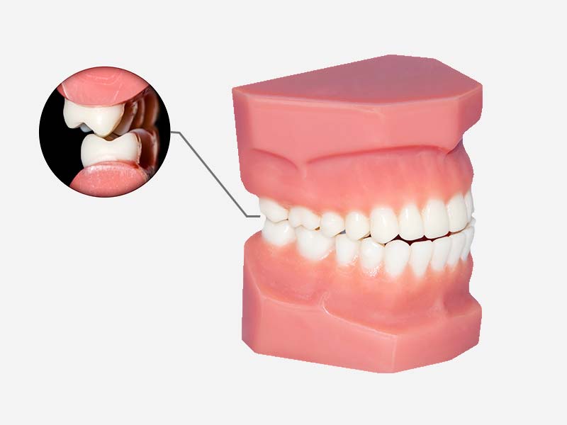 顳顎關節障礙的鑑別診斷